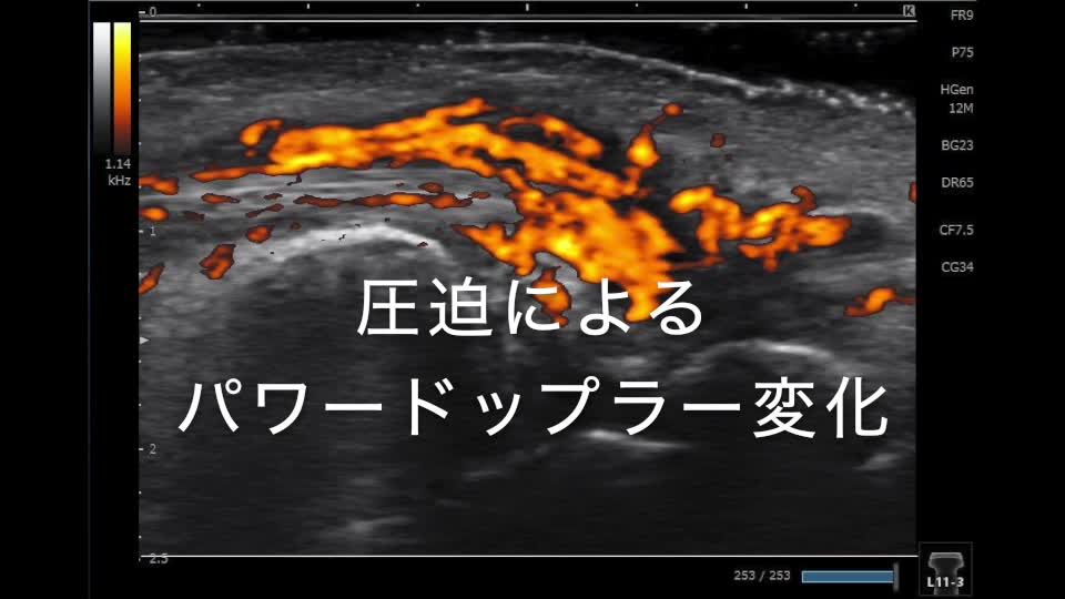 55巻5号　川合聡史先生　動画1