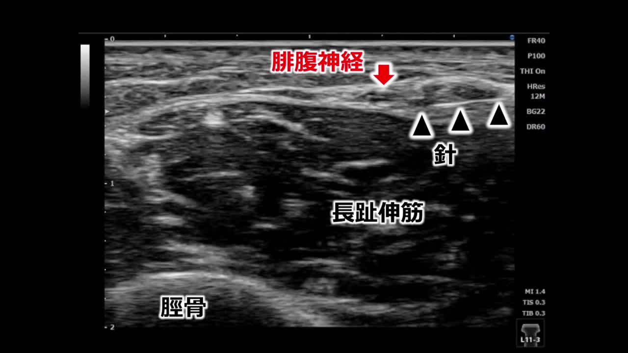 55巻5号　面谷透先生　動画1