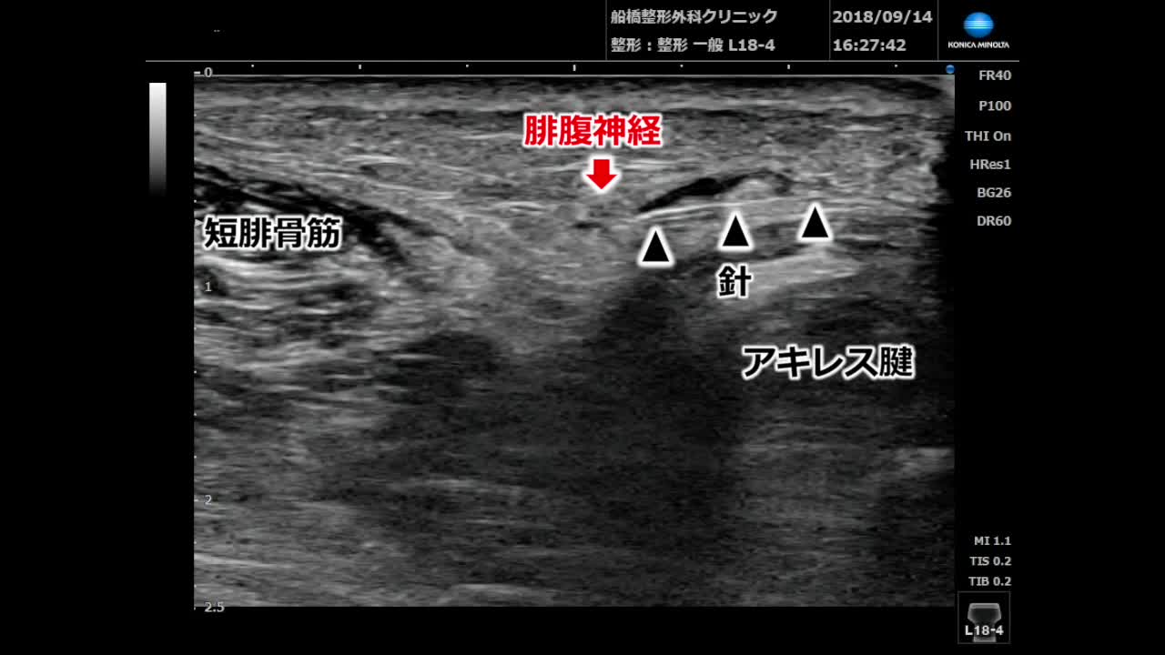 55巻5号　面谷透先生　動画2