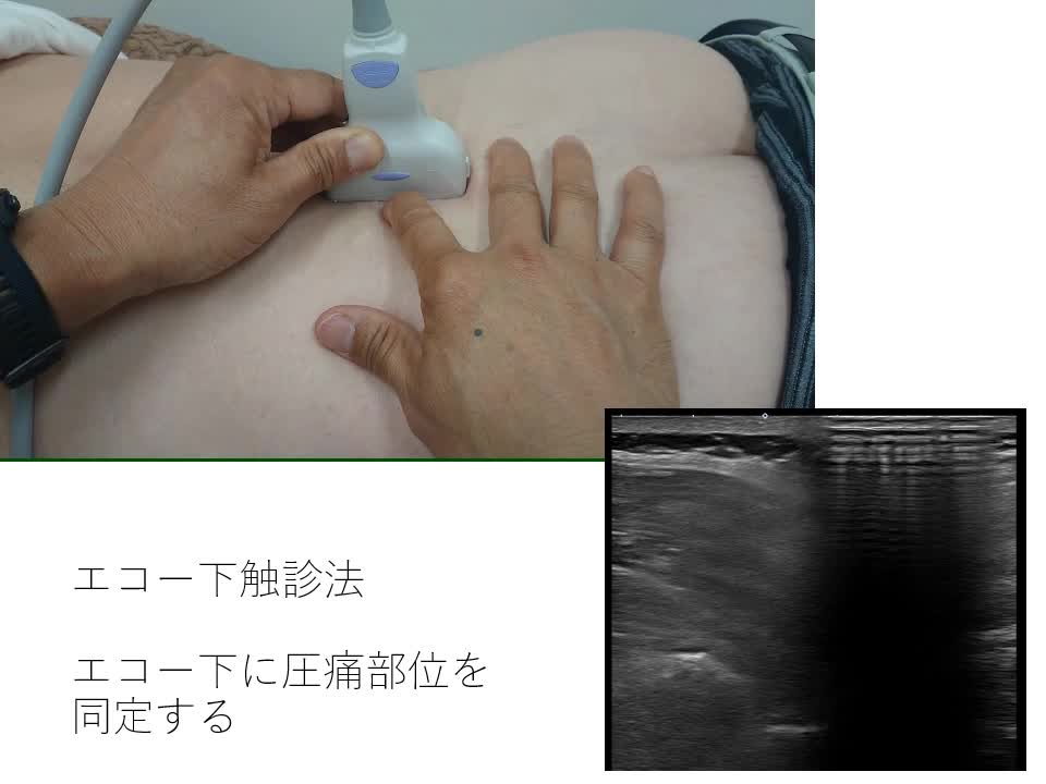 動画4　Sonopalpation