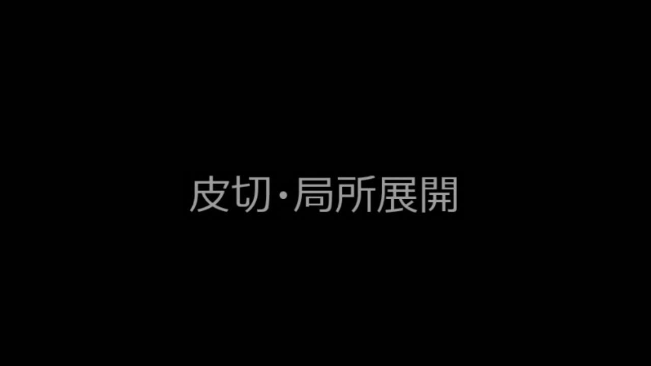 動画3　右上腕骨遠位 肘頭骨切りアプローチ...